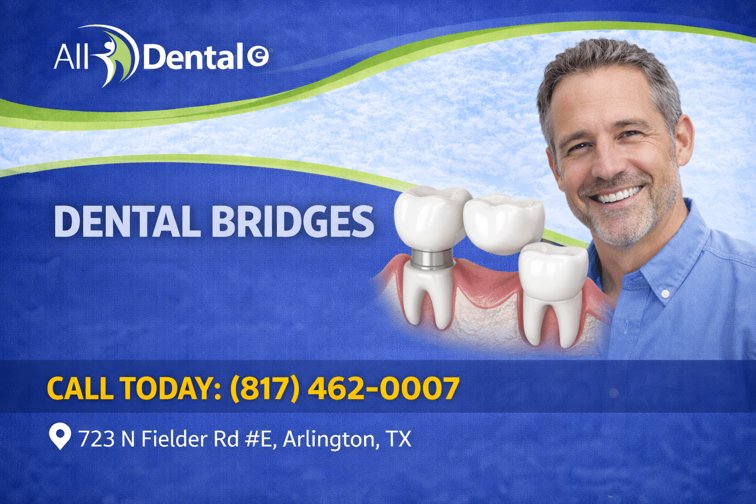 Dental Bridges near Arlington TX